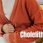 Cholelithiasis